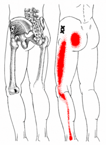 Hip Pain / Bursitis