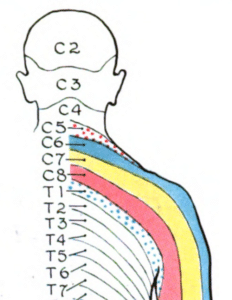 A pinched nerve in the neck can cause referred pain in the upper back between the shoulder blades
