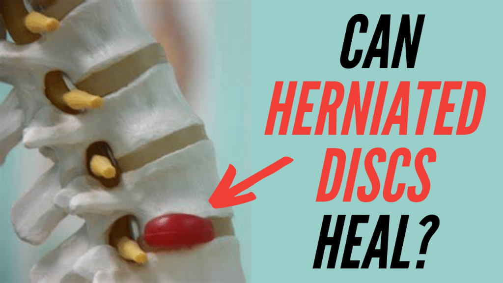 Can Herniated Discs Heal By Themselves Without Surgery?