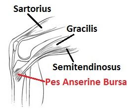 The pes anserine tendons are a common cause of inner knee pain.