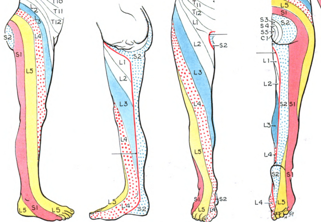 running with foot pain on top of the foot can be caused L5 radiculopathy