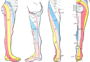 pain on outside of the foot can be caused by S1 radiculopathy