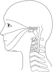 The trigeminocervical nucleus can be a reason for neck pain causing headaches