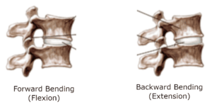 Backward bending can cause pain in legs when walking if you have spinal stenosis. 