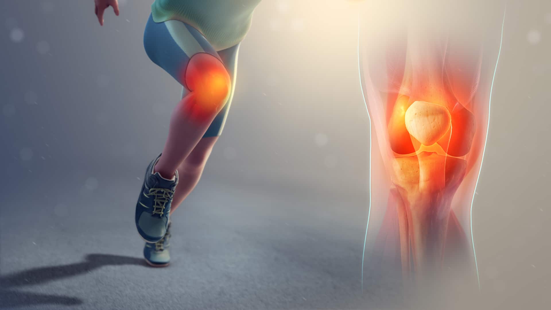 treatment for patellofemoral pain syndrome and runner's knee