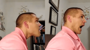 TMJ opening with poor vs good posture