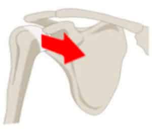 Anterior glide syndrome is one cause of shoulder pain
