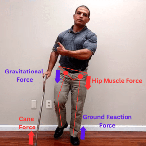 Using a cane can help you walk without a limp