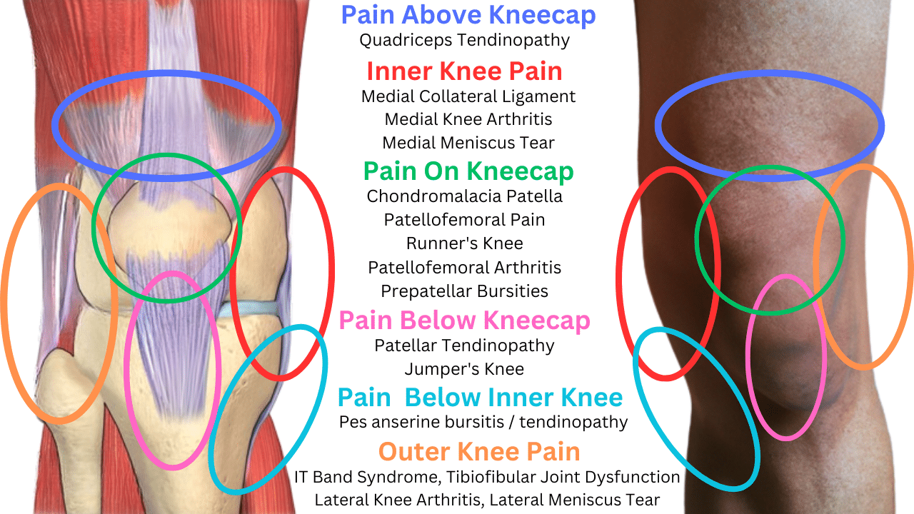 Interior Knee Pain Matttroy