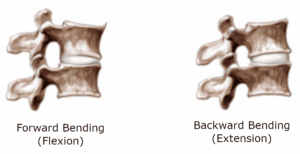 Backward walking causes an increase in lumbar extensor activity. Conversely, forward walking on an incline treadmill encourages lumbar flexion.