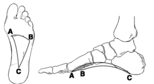 Improve walking gait by landing on your midfoot so that the 3 arches of your foot act as shock absorbers.