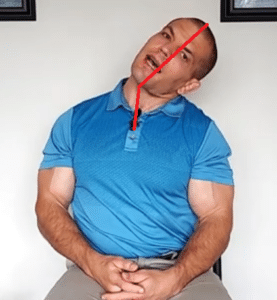 Neck pain exercise - upper trapezius stretch with segment lines
