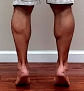 heel raise exercise for subacute ball of foot pain