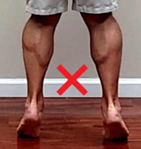strengthening exercise for ankle #1 - heel raise incorrect eversion