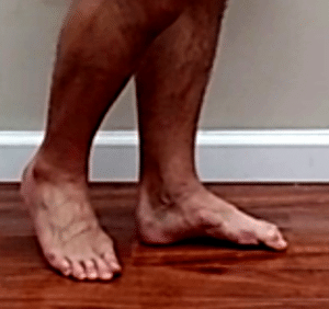 foot arch lift exercise for hip pain caused by overpronation