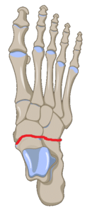 Midtaral joint