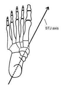 Pronatation around the subtalar axis of the foot can cause out-toeing. 