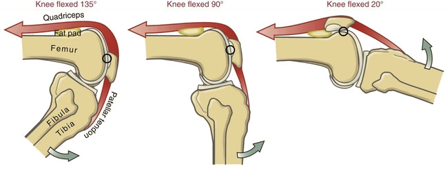 Sitting with the knee bent for long periods can cause front of knee stiffness after sitting