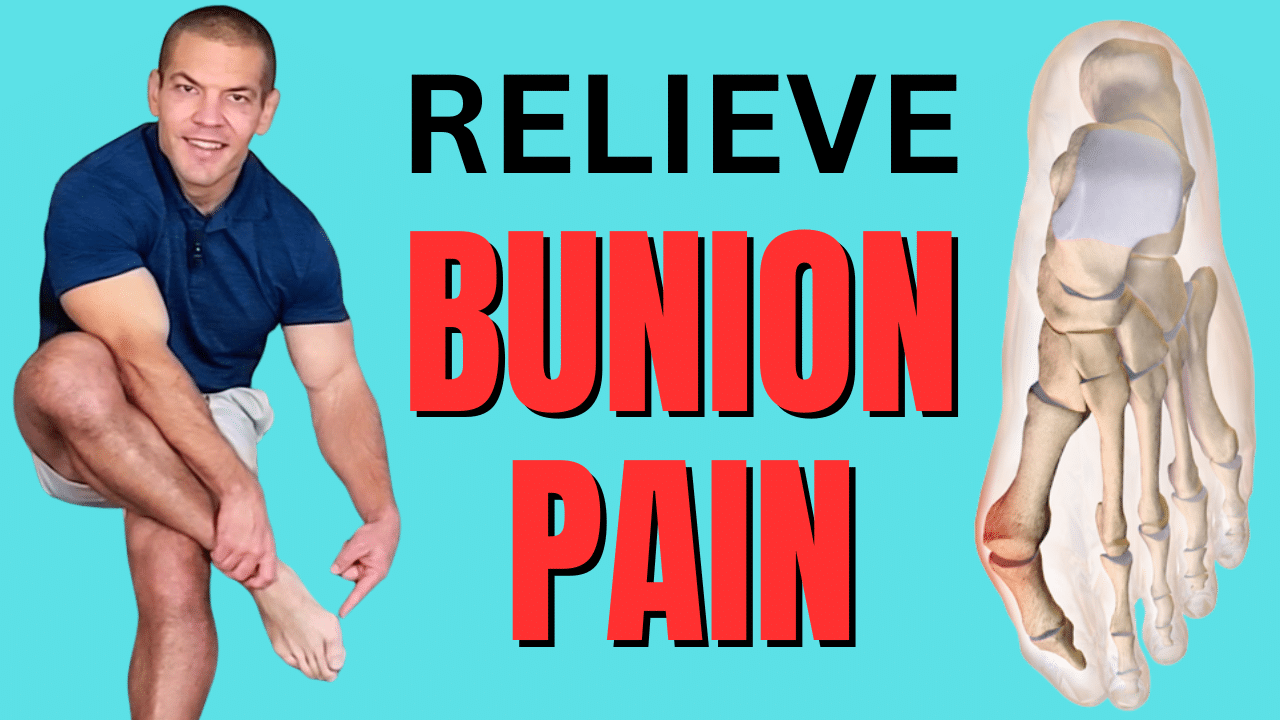 Treating A Bunion Without Surgery