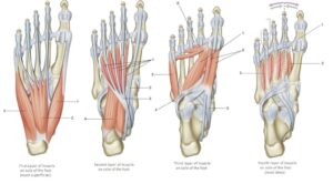 The intrinsic muscles of the foot can cause foot arch pain walking