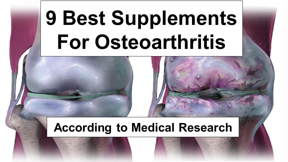 Best Supplements For Osteoarthritis