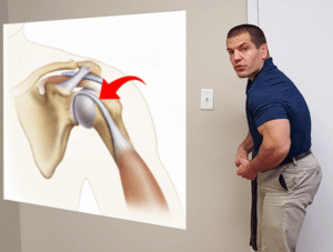 Rounded shoulder posture can cause rotator cuff and shoulder pain