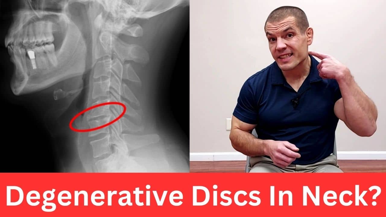 3 Exercises For Cervical Spine Degenerative Disc Disease