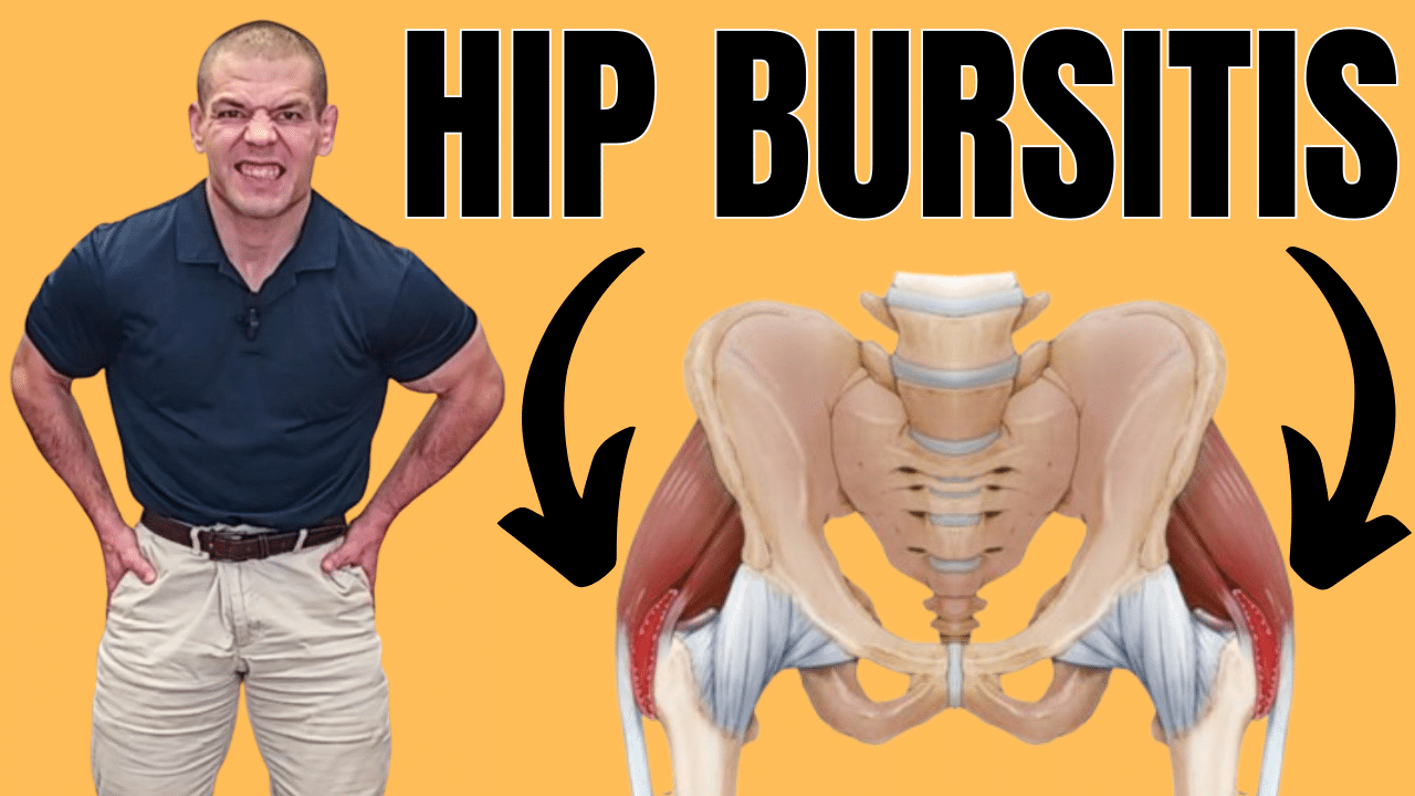 Bursitis In Hips? Exercises To Relieve Bilateral Trochanteric Bursitis