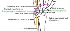 Guyon canal syndrome cause numbness in little finger