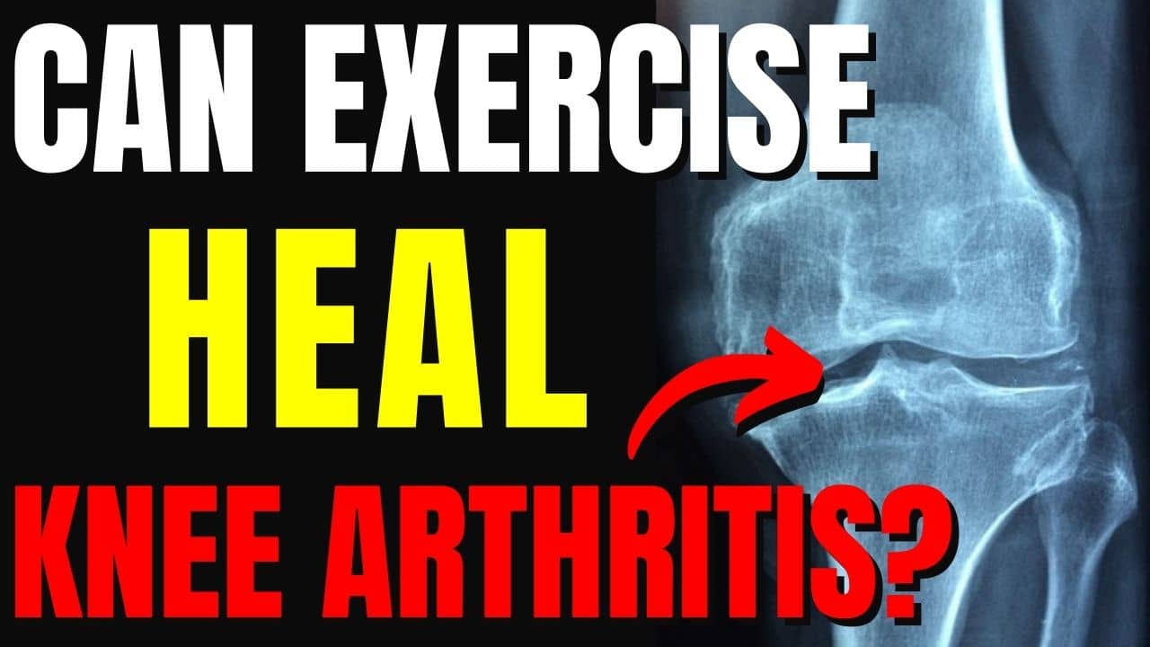 Can Exercise Heal Knee Arthritis? How To Rebuild Cartilage Naturally
