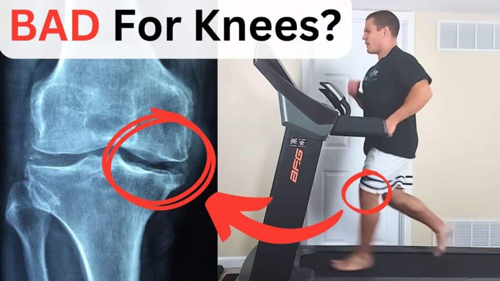Is Running Bad for Your Knees? How to Run with Knee Arthritis