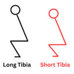 long and short tibia for knees over toes