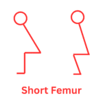 short femur for knees over toes