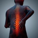 Low Back Pain More 4 Life Physical Therapy St. Louis, MO 63011 63125 63129